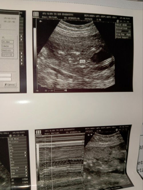 Sure na kaya? Naka bukaka naman kasi sya 😅