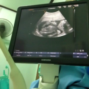 อยากถามแม่ๆเรื่องเพศลูกค่ะ👶