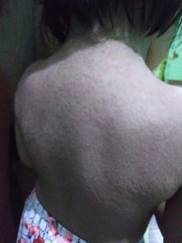 Bungang araw