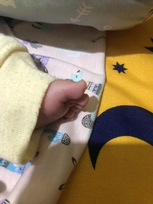 Seperti benjolan di jari kaki