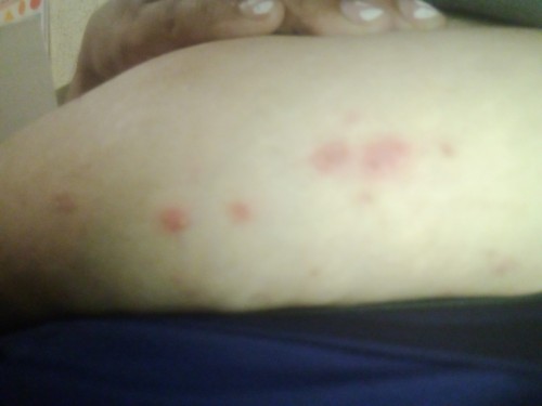 Halo mga mamshe tanong ko lang po sinong naka ranas nito ..makatu po kasi.. Im 2months pregnant po
