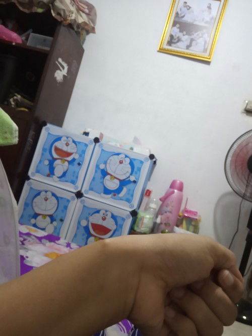 Benjolan di pergelangan tangan