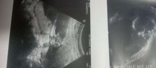 ช่วยดูหน่อยค่ะหมอบอกชายมีสิทเป็นหญิงได้ไหม,..แม่อยากได้หญิงมากๆ