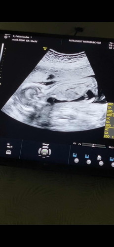 จิ๋วชอบนอนคว่ำ