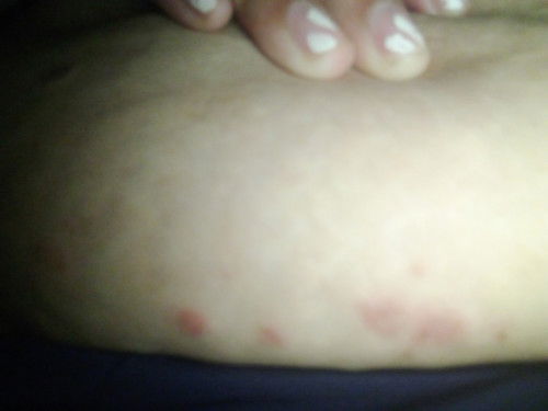 Hi mga mamshe tanong ko lang po sinong naka ranas nito makati po kasi im 2 months pregnant na po..