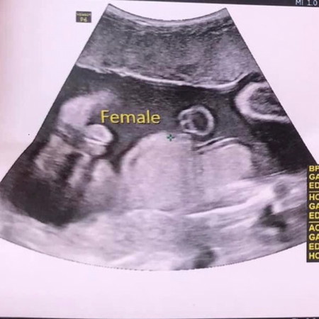 กังวลเล็กน้อยเรือเพศลูกค่ะ