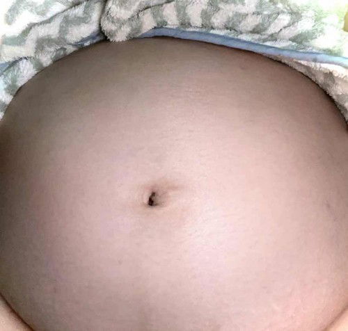 สะดือคว่ำหรือหงายดูยังไงคะแม่ๆ