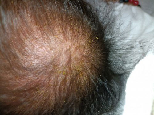 Cradle cap ba o ano?