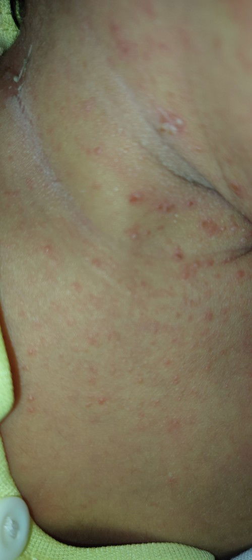 Share dong bun yg leher anak nya baru lahir bruntusan.. Lehernya pendek . Gymncara menghilangkan ny?