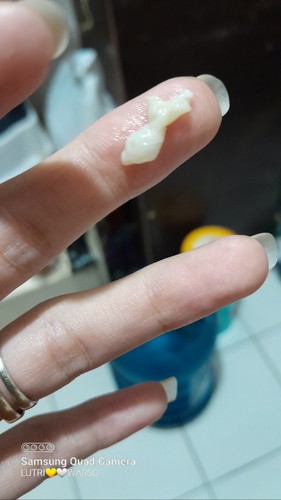 Wajar gak si bun klo dd dah 2 hari ini gak ada gerakan dan pas hb sama suami keluar kya gumpln putih
