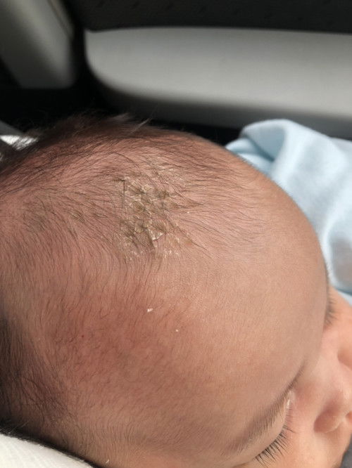 หัวน้องเป็นแบบนี้เกิดจากอะไรคะ