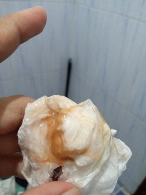 flek atau lendir biasa?