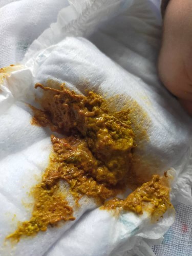 Saja nak tanya pendapat mommy ii