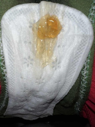 PRIMROSE OIL