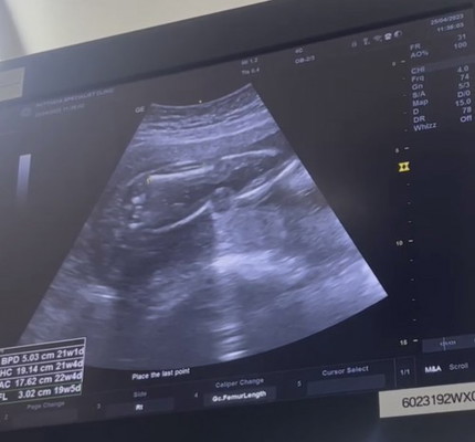 เหนื่อยกันไหมคะ