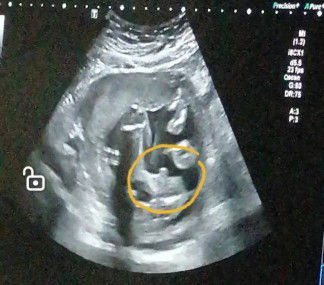 ตั้งชื่อลูกชาย