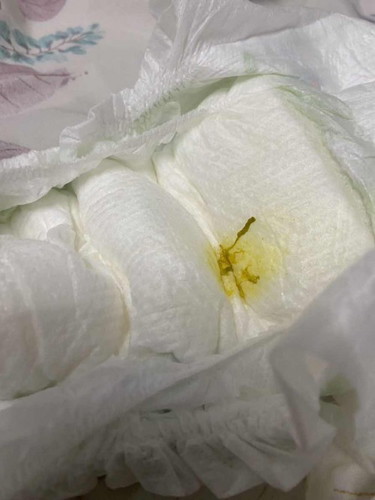 Normal ke najis anak mcm ni?