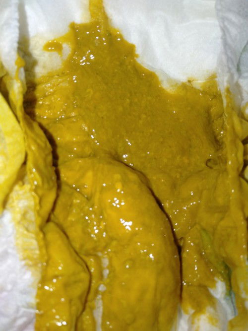 Bayi umur 2 bulan lebih 9 hari ini pupnya normal ap gk ya bund berlendir gt