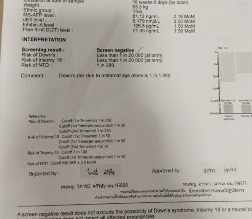 แม่ๆช่วยดูค่าความเสี่ยงดาวซิมโดรมให้หน่อยค่ะ