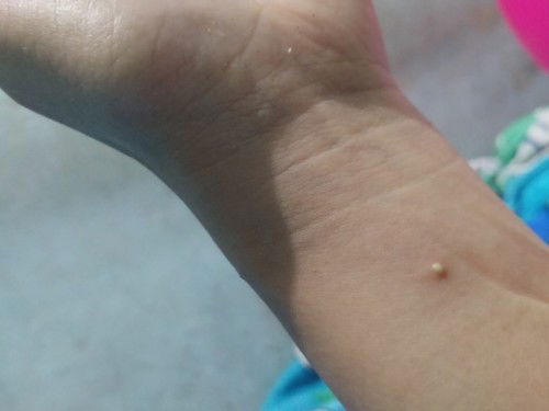 tolong bantu jawab mungkin ada yg pernah ngalamin