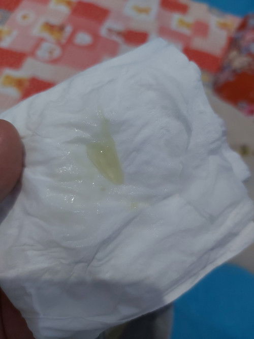 Keputihan atau tanda akan melahirkan?