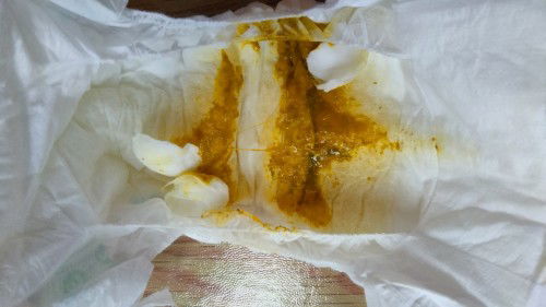 Pup bayi kuning ada hijaunya