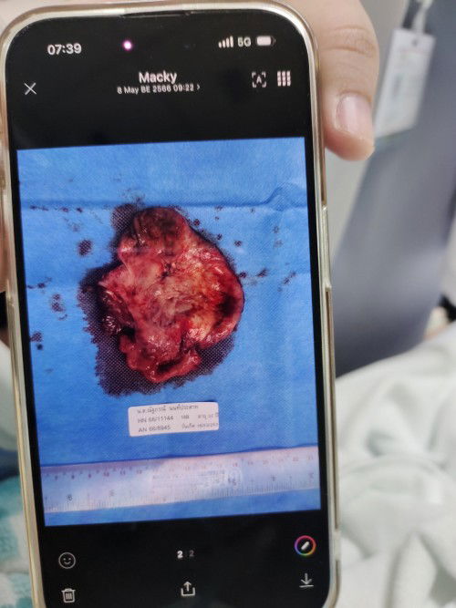 อัพเดทซีส ep3