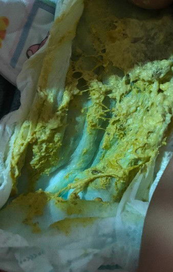 Ano po normal color Ng poop Ng six months old baby