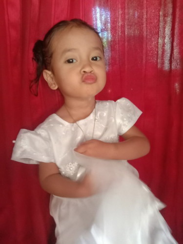 Anak saya sudah 2 tahun berat badan hanya 7kilo