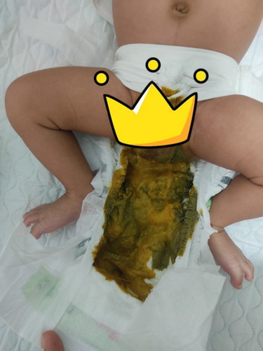 Popo ni baby