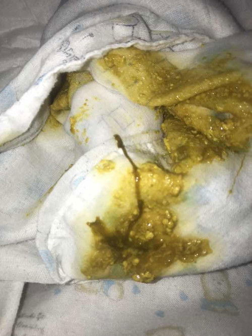 สอบถามหน่อยค่ะแม่ๆ