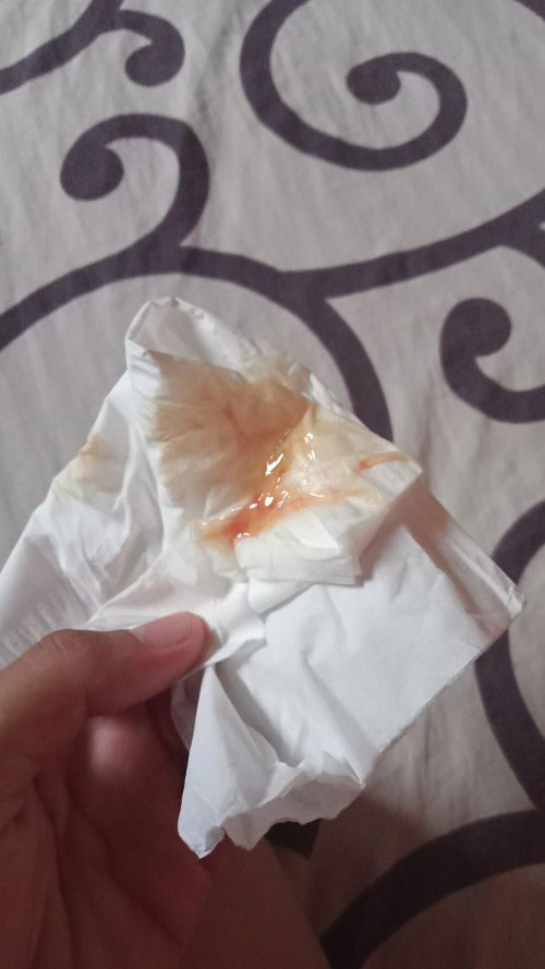 Apakah ini termasuk tanda mau lahiran ?