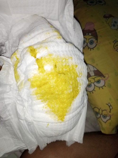 mag 6 months na si bb sa 13 simula kahapon ganyan lang poop nya kahapon green na green tapos