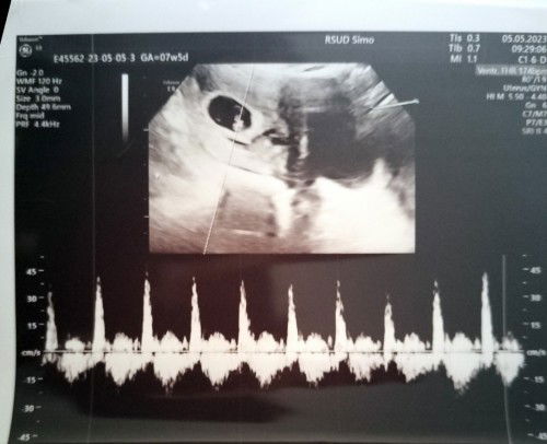 Hamil anak kedua ❤️