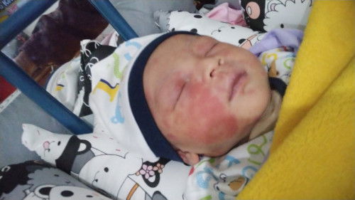 Mau tanya knpa ya bayi umur 2 hari mukanya merah² gini alergi atau apa yah