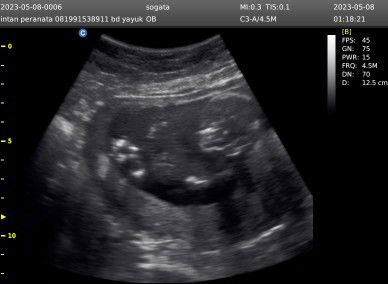 Kehamilan 15week 😇