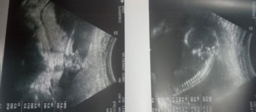 แบบนี้มีสิทธิ์เป็นหญิงได้ไหม