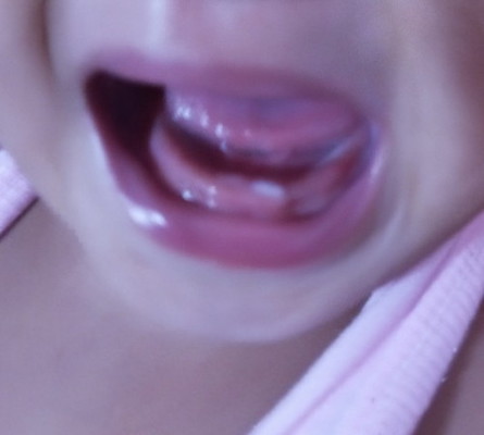 FIRST TOOTH