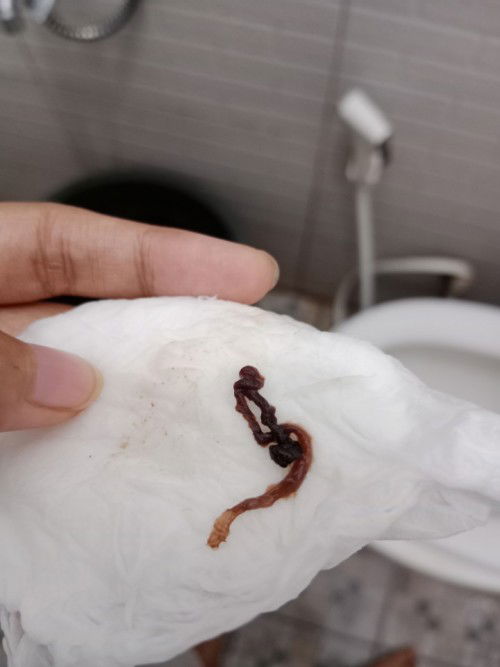 Keluar gumpalan hamil 8w