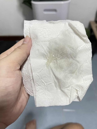 มีแบบนี้ออกมา5วันติดค่ะ