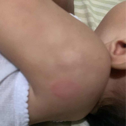 Bintik putih dan merah seperti panj