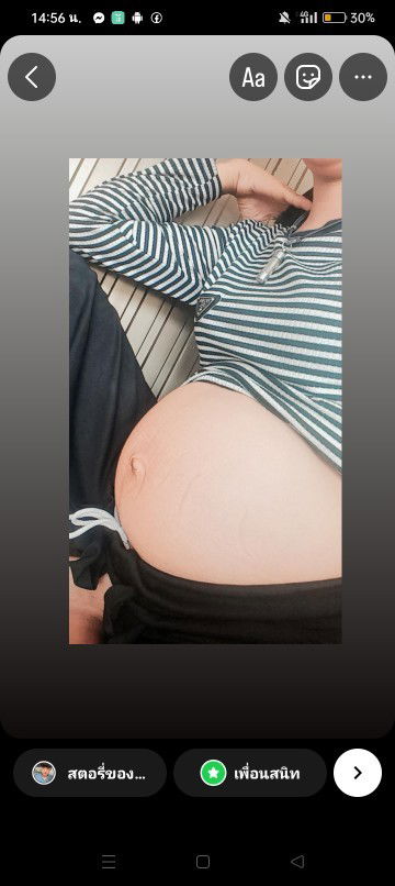 เสียวจิมิเหมือนคนเป้นนิ่วมีแม่ท่านไหนเป้นบ้างคะตอนนี้9เดือน1อาทิตละคะ
ใครรุ้ช่วยบอกหน่อยนะคะท้องแรก