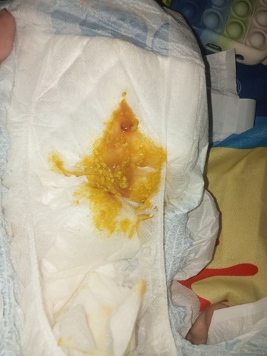 Pasintabi Po ,
Hi ask ko lang Po if normal tong ganito sa my pupu Ng baby ko , parang dugo Po kc