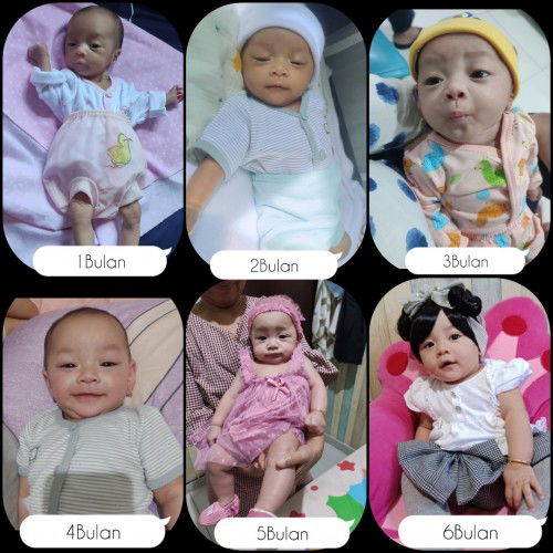 Sharing Bayi Premature