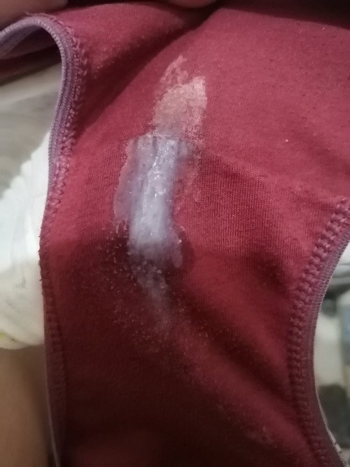 MUCUS PLUG OR WHITE DISCHARGE