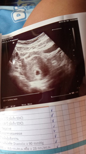 ขอสอบถามผู้รู้ค่ะ