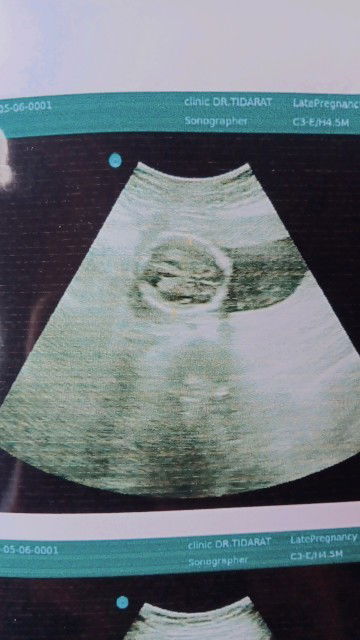 ผู้หญิง100%มั้ยค่ะแม่ๆกลัวจะเปลี่ยน😅😅😅สอบถามแม่ๆหน่อยค่ะ