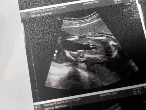 สอบถามแม่ๆหน่อยค่ะ