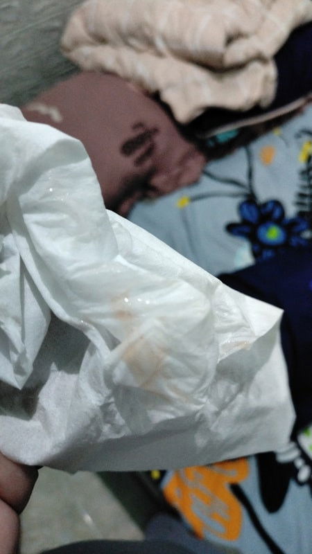 Lendir darah usia kehamilan 39minggu