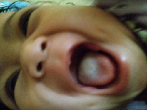 Jamur/bekas makanan?